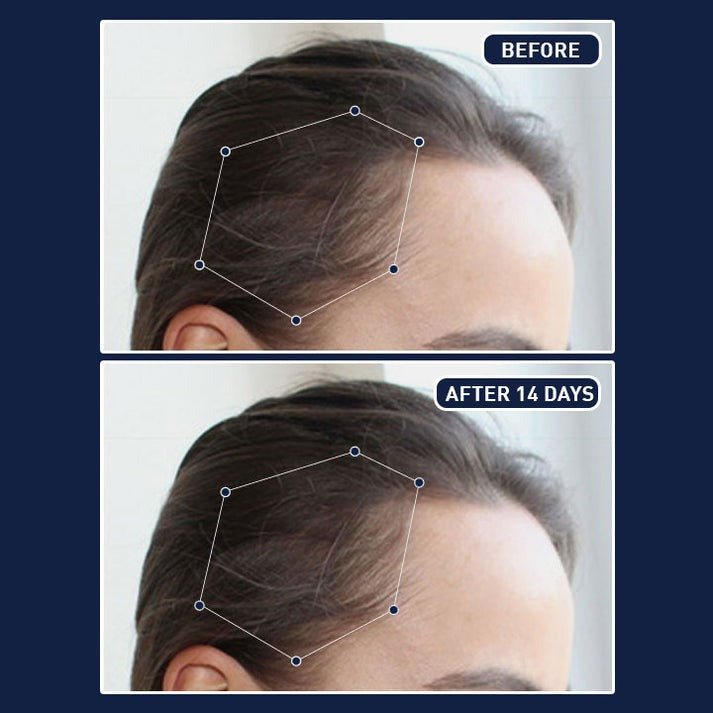 FEG- Hair Nourishing Spray (50ml) Buy 1 Get 1 Free