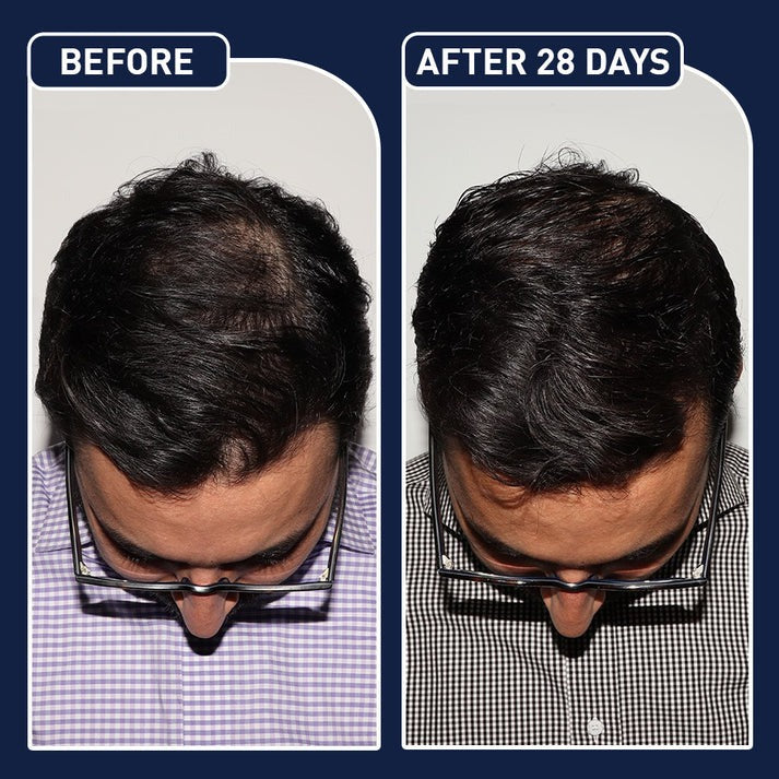 FEG- Hair Nourishing Spray (50ml) Buy 1 Get 1 Free